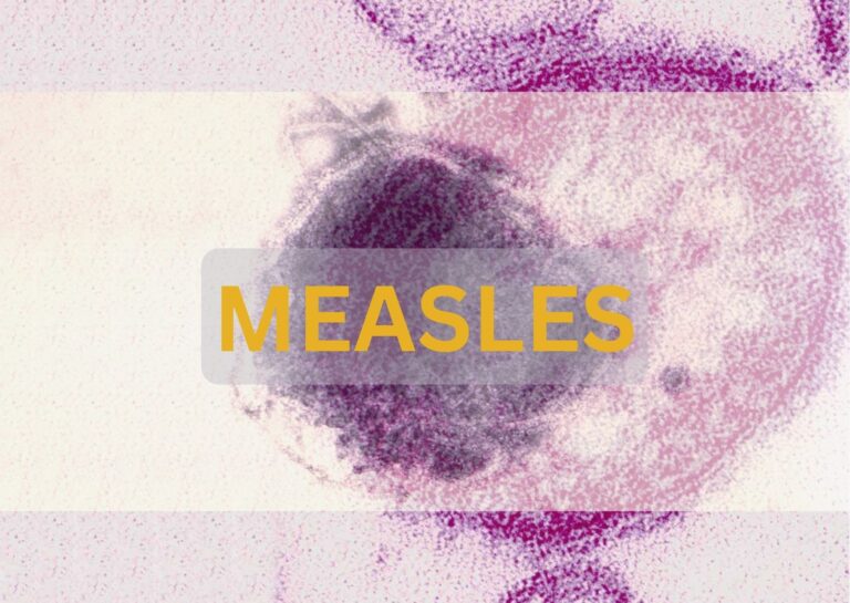 Image showing the Measles virus